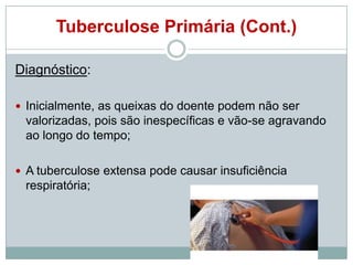 Tuberculose Primária (Cont.)
Diagnóstico:
 Inicialmente, as queixas do doente podem não ser

valorizadas, pois são inespecíficas e vão-se agravando
ao longo do tempo;
 A tuberculose extensa pode causar insuficiência

respiratória;

 