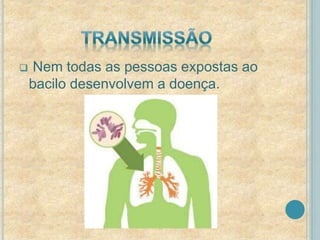  Nem todas as pessoas expostas ao 
bacilo desenvolvem a doença. 
 