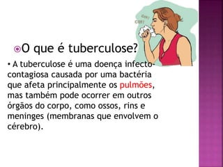 O que é tuberculose?
• A tuberculose é uma doença infecto-
contagiosa causada por uma bactéria
que afeta principalmente os pulmões,
mas também pode ocorrer em outros
órgãos do corpo, como ossos, rins e
meninges (membranas que envolvem o
cérebro).
 