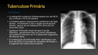 • A radiografia evidencia linfadenopatia em até 96 %
das crianças e 43 % de adultos.
• A linfadenopatia é tipicamente unilateral e do lado
direito , envolvendo o hilo e região paratraqueal
direita , apesar de ser bilateral em cerca de um
terço dos casos .
• Qualquer linfonodo maior do que 2 cm de
diâmetro , geralmente tem um centro hipodenso
secundário a necrose no CT é altamente sugestivos
de doença ativa .
• A combinação de linfonodo hilar calcificada e um
foco de Ghon é chamado de complexo de Ranke e
é sugestivo de tuberculose anterior.
Linfonodopatia
 