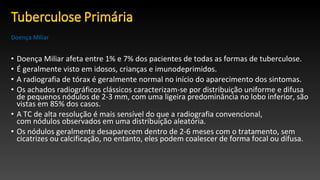 • Doença Miliar afeta entre 1% e 7% dos pacientes de todas as formas de tuberculose.
• É geralmente visto em idosos, crianças e imunodeprimidos.
• A radiografia de tórax é geralmente normal no início do aparecimento dos sintomas.
• Os achados radiográficos clássicos caracterizam-se por distribuição uniforme e difusa
de pequenos nódulos de 2-3 mm, com uma ligeira predominância no lobo inferior, são
vistas em 85% dos casos.
• A TC de alta resolução é mais sensível do que a radiografia convencional,
com nódulos observados em uma distribuição aleatória.
• Os nódulos geralmente desaparecem dentro de 2-6 meses com o tratamento, sem
cicatrizes ou calcificação, no entanto, eles podem coalescer de forma focal ou difusa.
Doença Miliar
 