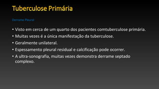 • Visto em cerca de um quarto dos pacientes comtuberculose primária.
• Muitas vezes é a única manifestação da tuberculose.
• Geralmente unilateral.
• Espessamento pleural residual e calcificação pode ocorrer.
• A ultra-sonografia, muitas vezes demonstra derrame septado
complexo.
Derrame Pleural
 