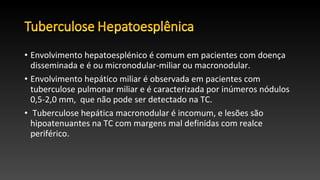 • Envolvimento hepatoesplénico é comum em pacientes com doença
disseminada e é ou micronodular-miliar ou macronodular.
• Envolvimento hepático miliar é observada em pacientes com
tuberculose pulmonar miliar e é caracterizada por inúmeros nódulos
0,5-2,0 mm, que não pode ser detectado na TC.
• Tuberculose hepática macronodular é incomum, e lesões são
hipoatenuantes na TC com margens mal definidas com realce
periférico.
 