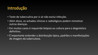 • Teste de tuberculina por si só não exclui infecção.
• Além disso, os achados clínicos e radiológicos podem mimetizar
outras doenças.
• Em muitos casos é requerido biópsia ou cultura para o diagnóstico
definitivo.
• É importante entender a distribuição típica, padrões e manifestações
de imagem da tuberculose.
 