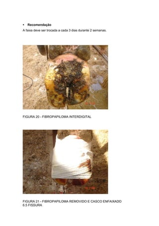 Recomendação
A faixa deve ser trocada a cada 3 dias durante 2 semanas.
FIGURA 20 - FIBROPAPILOMA INTERDIGITAL
FIGURA 21 - FIBROPAPILOMA REMOVIDO E CASCO ENFAIXADO
6.5 FISSURA
 