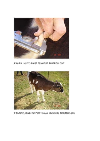 FIGURA 1 - LEITURA DE EXAME DE TUBERCULOSE
FIGURA 2 - BEZERRA POSITIVA AO EXAME DE TUBERCULOSE
 