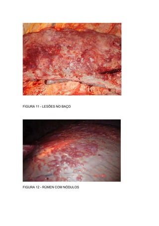 FIGURA 11 - LESÕES NO BAÇO
FIGURA 12 - RÚMEN COM NÓDULOS
 