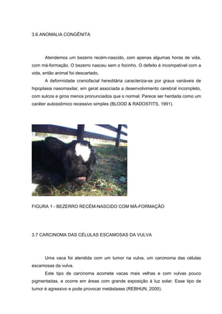 3.6 ANOMALIA CONGÊNITA
Atendemos um bezerro recém-nascido, com apenas algumas horas de vida,
com má-formação. O bezerro nasceu sem o focinho. O defeito é incompatível com a
vida, então animal foi descartado.
A deformidade craniofacial hereditária caracteriza-se por graus variáveis de
hipoplasia nasomaxilar, em geral associada a desenvolvimento cerebral incompleto,
com sulcos e giros menos pronunciados que o normal. Parece ser herdada como um
caráter autossômico recessivo simples (BLOOD & RADOSTITS, 1991).
FIGURA 1 - BEZERRO RECÉM-NASCIDO COM MÁ-FORMAÇÃO
3.7 CARCINOMA DAS CÉLULAS ESCAMOSAS DA VULVA
Uma vaca foi atendida com um tumor na vulva, um carcinoma das células
escamosas da vulva.
Este tipo de carcinoma acomete vacas mais velhas e com vulvas pouco
pigmentadas, e ocorre em áreas com grande exposição à luz solar. Esse tipo de
tumor é agressivo e pode provocar metástases (REBHUN, 2000).
 