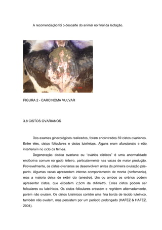 A recomendação foi o descarte do animal no final da lactação.
FIGURA 2 - CARCINOMA VULVAR
3.8 CISTOS OVARIANOS
Dos exames ginecológicos realizados, foram encontrados 59 cistos ovarianos.
Entre eles, cistos foliculares e cistos luteínicos. Alguns eram afuncionais e não
interferiam no ciclo da fêmea.
Degeneração cística ovariana ou “ovários císticos” é uma anormalidade
endócrina comum no gado leiteiro, particularmente nas vacas de maior produção.
Provavelmente, os cistos ovarianos se desenvolvem antes da primeira ovulação pós-
parto. Algumas vacas apresentam intenso comportamento de monta (ninfomania),
mas a maioria deixa de exibir cio (anestro). Um ou ambos os ovários podem
apresentar cistos, que excedem 2,5cm de diâmetro. Estes cistos podem ser
foliculares ou luteínicos. Os cistos foliculares crescem e regridem alternadamente,
porém não ovulam. Os cistos luteínicos contêm uma fina borda de tecido luteínico,
também não ovulam, mas persistem por um período prolongado (HAFEZ & HAFEZ,
2004).
 