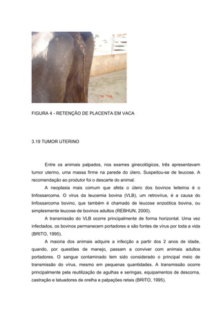 FIGURA 4 - RETENÇÃO DE PLACENTA EM VACA
3.19 TUMOR UTERINO
Entre os animais palpados, nos exames ginecológicos, três apresentavam
tumor uterino, uma massa firme na parede do útero. Suspeitou-se de leucose. A
recomendação ao produtor foi o descarte do animal.
A neoplasia mais comum que afeta o útero dos bovinos leiteiros é o
linfossarcoma. O vírus da leucemia bovina (VLB), um retrovírus, é a causa do
linfossarcoma bovino, que também é chamado de leucose enzoótica bovina, ou
simplesmente leucose de bovinos adultos (REBHUN, 2000).
A transmissão do VLB ocorre principalmente de forma horizontal. Uma vez
infectados, os bovinos permanecem portadores e são fontes de vírus por toda a vida
(BRITO, 1995).
A maioria dos animais adquire a infecção a partir dos 2 anos de idade,
quando, por questões de manejo, passam a conviver com animais adultos
portadores. O sangue contaminado tem sido considerado o principal meio de
transmissão do vírus, mesmo em pequenas quantidades. A transmissão ocorre
principalmente pela reutilização de agulhas e seringas, equipamentos de descorna,
castração e tatuadores de orelha e palpações retais (BRITO, 1995).
 