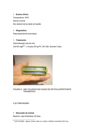 Exame clínico
Temperatura: 40ºC
Atonia ruminal
Dor abdominal ao teste do bastão
Diagnóstico
Reticuloperitonite traumática
Tratamento
Administração oral de imã
Cef-50 mg®43
: 1 ml para 50 kg PV, IM, SID, durante 3 dias
FIGURA 6 - IMÃ UTILIZADO EM CASOS DE RETICULOPERITONITE
TRAUMÁTICA.
4.26 TIMPANISMO
Descrição do animal
Bezerra, raça holandesa, 60 dias.
43
CEF-50 MG® - Agener União. Cada mL contém: Ceftiofur (cloridrato) 50,0 mg.
 