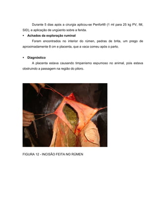 Durante 5 dias após a cirurgia aplicou-se Penfort® (1 ml para 25 kg PV, IM,
SID), e aplicação de ungüento sobre a ferida.
Achados da exploração ruminal
Foram encontrados no interior do rúmen, pedras de brita, um prego de
aproximadamente 8 cm e placenta, que a vaca comeu após o parto.
Diagnóstico
A placenta estava causando timpanismo espumoso no animal, pois estava
obstruindo a passagem na região do piloro.
FIGURA 12 - INCISÃO FEITA NO RÚMEN
 