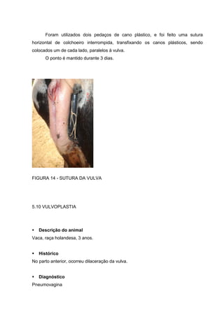 Foram utilizados dois pedaços de cano plástico, e foi feito uma sutura
horizontal de colchoeiro interrompida, transfixando os canos plásticos, sendo
colocados um de cada lado, paralelos à vulva.
O ponto é mantido durante 3 dias.
FIGURA 14 - SUTURA DA VULVA
5.10 VULVOPLASTIA
Descrição do animal
Vaca, raça holandesa, 3 anos.
Histórico
No parto anterior, ocorreu dilaceração da vulva.
Diagnóstico
Pneumovagina
 