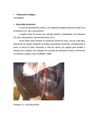 Tratamento cirúrgico
Vulvoplastia
Descrição da técnica:
A vaca foi devidamente contida, e foi realizado analgesia epidural caudal (4 ml
de lidocaína 2%, sem vasocontritor).
A região vulvar foi lavada com solução iodada e anestesiada com lidocaína
2% (sem vasocontritor), aproximadamente 15 ml.
Foram feitas duas incisões na comissura ventral da vulva, uma de cada lado,
reavivando as bordas, atingindo os tecidos subcutâneos profundos, paralelamente à
vulva. A sutura foi feita, colocando a mão por dentro (na vagina) para facilitar o
manejo com a agulha, com categute 3.0 e pontos de colchoeiro contínuo, diminuindo
ao máximo o espaço morto (TURNER, 1999).
FIGURA 15 - VULVOPLASTIA
 