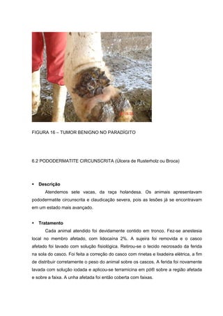 FIGURA 16 – TUMOR BENIGNO NO PARADÍGITO
6.2 PODODERMATITE CIRCUNSCRITA (Úlcera de Rusterholz ou Broca)
Descrição
Atendemos sete vacas, da raça holandesa. Os animais apresentavam
pododermatite circunscrita e claudicação severa, pois as lesões já se encontravam
em um estado mais avançado.
Tratamento
Cada animal atendido foi devidamente contido em tronco. Fez-se anestesia
local no membro afetado, com lidocaína 2%. A sujeira foi removida e o casco
afetado foi lavado com solução fisiológica. Retirou-se o tecido necrosado da ferida
na sola do casco. Foi feita a correção do casco com rinetas e lixadeira elétrica, a fim
de distribuir corretamente o peso do animal sobre os cascos. A ferida foi novamente
lavada com solução iodada e aplicou-se terramicina em pó® sobre a região afetada
e sobre a faixa. A unha afetada foi então coberta com faixas.
 