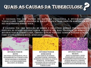 qqUaIS aSUaIS aS CCaUSaS DaaUSaS Da TTUBERCULOSEUBERCULOSEqqUaIS aSUaIS aS CCaUSaS DaaUSaS Da TTUBERCULOSEUBERCULOSE??
é CaUSaDa POR Uma ESPéCIE DE BaCTéRIa PaTOgêNICa, a myCROBaCTERIUm
TUBERCULOSIS, TamBém CHamaDa DE BaCILO DE KOCH, NOmE DaDO Em HOmENagEm aO
SEU DESCOBRIDOR ROBERT KOCH.
é CaUSaDa POR Uma INfECÇÃO NO HOmEm E Em OUTROS aNImaIS POR DIfERENTES
ESPéCIES DO gêNERO myCOBaCTERIUm. a ESPéCIE qUE maIS TRaNSmITE aO HOmEm é O
myCOBaCTERIUm TUBERCULOSIS, EmBORa OUTRaS ESPéCIES TamBém POSSam O fazER,
COmO myCOBaCTERIUm BOvIS, afRICaNUm E mICROTI.
myCOBaCTERIUm
BOvIS
BaCTéRIa RESPONSávEL PELa
TRaNSmISSÃO Da TUBERCULOSE
ENTRE BOvINOS E Em mENOR
gRaU a OUTROS mamIfEROS
INCLUSIvE aO HOmEm.
myCOBaCTERIUm
afRICaNUm
Uma ESPéCIE DO gêNERO
myCOBaCTERIUm, COm maIOR
INCIDêNCIa Em PaíSES Da áfRICa
OCIDENTaL. OS SINTOmaS
CaUSaDOS POR SUa INfECÇÃO
aSSEmELHam-SE aOS DE m.
TUBERCULOSIS.
myCOBaCTERIUm
mICROTI
INfECTa ROEDORES, SENDO
NORmaLmENTE ISOLaDO Em
mUSaRaNHOS PERTENCENTES aO
géNERO mICROTUS, PODENDO
TamBém CaUSaR DOENÇa Em
HUmaNOS ImUNOCOmPROmETIDOS.
 