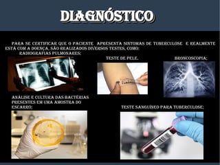 DIagNÓSTICODIagNÓSTICODIagNÓSTICODIagNÓSTICO
PaRa SE CERTIfICaR qUE O PaCIENTE aPRESENTa SINTOmaS DE TUBERCULOSE E REaLmENTE
ESTá COm a DOENÇa, SÃO REaLIzaDOS DIvERSOS TESTES, COmO:
RaDIOgRafIaS PULmONaRES;
TESTE DE PELE. BRONCOSCOPIa;
aNáLISE E CULTURa DaS BaCTéRIaS
PRESENTES Em Uma amOSTRa DO
ESCaRRO; TESTE SaNgUíNEO PaRa TUBERCULOSE;
 