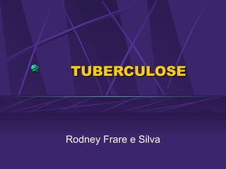 TUBERCULOSE



Rodney Frare e Silva
 