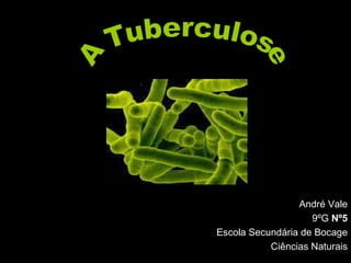 André Vale 9ºG  Nº5 Escola Secundária de Bocage Ciências Naturais A Tuberculose 