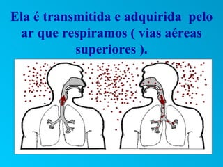 Ela é transmitida e adquirida pelo
 ar que respiramos ( vias aéreas
           superiores ).
 