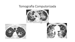 Tomografia Computorizada
 