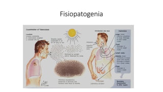 Fisiopatogenia
 