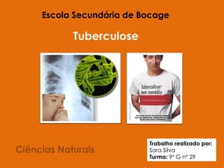Ciências Naturais Escola Secundária de Bocage Tuberculose   Trabalho realizado por:  Sara Silva Turma:  9º G nº 29 