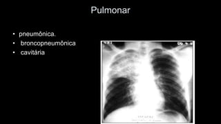 Pulmonar 
•pneumônica. 
•broncopneumônica 
•cavitária  