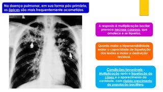 Na doença pulmonar, em sua forma pós-primária, os ápicessão mais frequentemente acometidos 
A resposta à multiplicação bacilar provoca necrose caseosa, que amolece e se liquefaz. 
Quanto maior a hipersensibilidade, maior a capacidade de liquefação das lesões e maior a destruição tecidual. 
Condições favoráveis - Multiplicaçãoapós a liquefação do cáseoe o aparecimento da cavidade, com rápido crescimento da população bacilífera.  