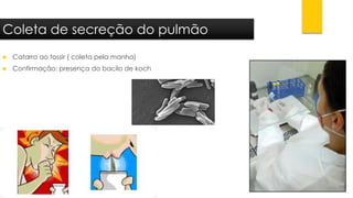 Catarro ao tossir ( coleta pela manha) 
Confirmação: presença do bacilo de koch 
Coleta de secreção do pulmão  