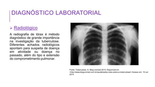 DIAGNÓSTICO LABORATORIAL
 Radiológico
A radiografia de tórax é método
diagnóstico de grande importância
na investigação da tuberculose.
Diferentes achados radiológicos
apontam para suspeita de doença
em atividade ou doença no
passado, além do tipo e extensão
do comprometimento pulmonar.
Fonte: Tuberculose. In: Blog Unimed 2014. Disponível em
<http://www.blogunimed.com.br/saude/saiba-mais-sobre-a-tuberculose/> Acesso em: 15 out
2014
 