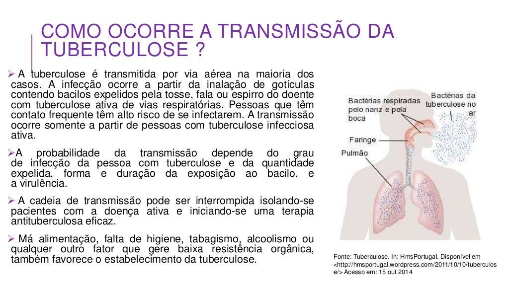 Tuberculose