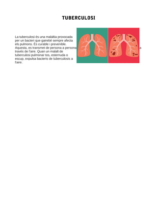 TUBERCULOSI
La tuberculosi és una malaltia provocada
per un bacteri que gairebé sempre afecta
els pulmons. És curable i prevenible.
Aquesta, es transmet de persona a persona a
través de l'aire. Quan un malalt de
tuberculosi pulmonar tos, esternuda o
escup, expulsa bacteris de tuberculosis a
l'aire.
 
