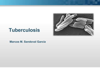 Tuberculosis Marcos M. Sandoval García  