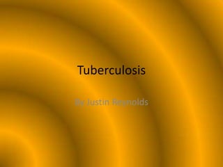 Tuberculosis By Justin Reynolds 