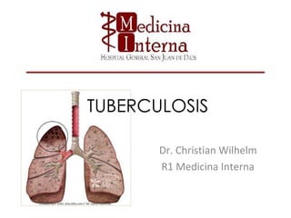 TUBERCULOSIS Dr. Christian Wilhelm R1 Medicina Interna  