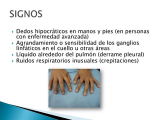 Dedos hipocráticos en manos y pies (en personas con enfermedad avanzada)Agrandamiento o sensibilidad de los ganglios linfáticos en el cuello u otras áreasLíquido alrededor del pulmón (derrame pleural)Ruidos respiratorios inusuales (crepitaciones)SIGNOS 
