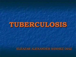 TUBERCULOSIS


 ELEAZAR ALEXANDER SÁNHEZ DIAZ
 