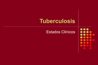 Tuberculosis
Estados Clínicos
 