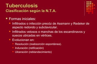 Tuberculosis
Clasificación según la N.T.A.
 Formas iniciales:
 Infiltrados o infección precóz de Assmann y Redeker de
aspecto redondo y subclavicular.
 Infiltrados vetosos o manchas de los escandinavos y
suecos ubicadas en vértices.
 Evolucionan en:
 Resolución (reabsorción espontánea).
 Induración (retificación)
 Ulceración (reblandecimiento)
 