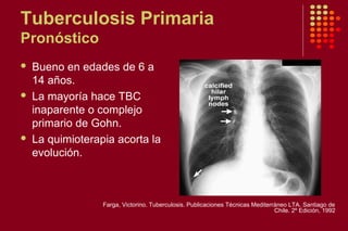 Tuberculosis Primaria
Pronóstico
 Bueno en edades de 6 a
14 años.
 La mayoría hace TBC
inaparente o complejo
primario de Gohn.
 La quimioterapia acorta la
evolución.
Farga, Victorino. Tuberculosis. Publicaciones Técnicas Mediterráneo LTA. Santiago de
Chile. 2º Edición, 1992
 