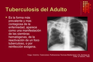 Tuberculosis del Adulto
 Es la forma más
prevalente y mas
contagiosa de la
enfermedad, aparece
como una manifestación
de las siembras
hematógenas, de la
reactivación de un foco
tuberculoso, o por
reinfección exógena.
Farga, Victorino. Tuberculosis. Publicaciones Técnicas Mediterráneo LTA. Santiago de
Chile. 2º Edición, 1992
 
