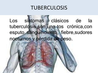 TUBERCULOSIS

Los síntomas clásicos de la
tuberculosis son una tos crónica,con
esputo sanguinolento, fiebre,sudores
nocturnos y pérdida de peso.
 