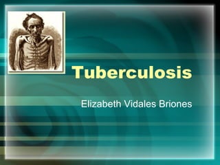 Tuberculosis Elizabeth Vidales Briones 