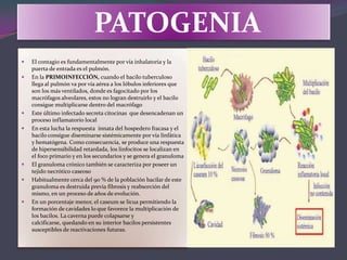Lobulo Infectado Tuberculosis | PPTX