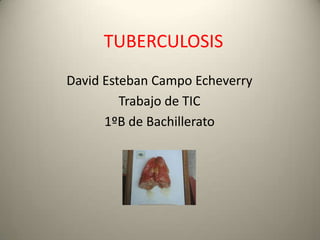 TUBERCULOSIS
David Esteban Campo Echeverry
Trabajo de TIC
1ºB de Bachillerato
 