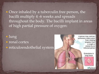  Once inhaled by a tuberculin free person, the
bacilli multiply 4 -6 weeks and spreads
throughout the body. The bacilli implant in areas
of high partial pressure of oxygen:
 lung
 renal cortex
 reticuloendothelial system
 