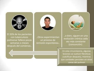 El 33% de los pacientes
con tuberculosis
pulmonar fallece pocas
semanas o meses
después del comienzo..
..Otros experimientan
un proceso de
remisión espontánea..
..o bien, siguen en una
evolución crónica cada
vez más constante
(consunción).
En esta circunstancia, algunas
lesiones se vuelven fibroticas
(calcifican después), mientras
que cavidades persisten en otras
zonas del pulmon
 