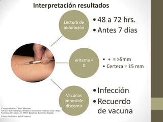 Interpretación resultados
Lectura de
induración
•48 a 72 hrs.
•Antes 7 días
eritema =
0
• + = >5mm
• Certeza = 15 mm
Vacunas
imposible
discernir
•Infección
•Recuerdo
de vacuna
 