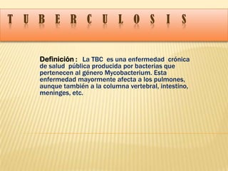 T U B E R C U L O S I S
Definición : La TBC es una enfermedad crónica
de salud pública producida por bacterias que
pertenecen al género Mycobacterium. Esta
enfermedad mayormente afecta a los pulmones,
aunque también a la columna vertebral, intestino,
meninges, etc.
 